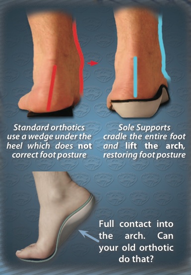 foot supination insoles
